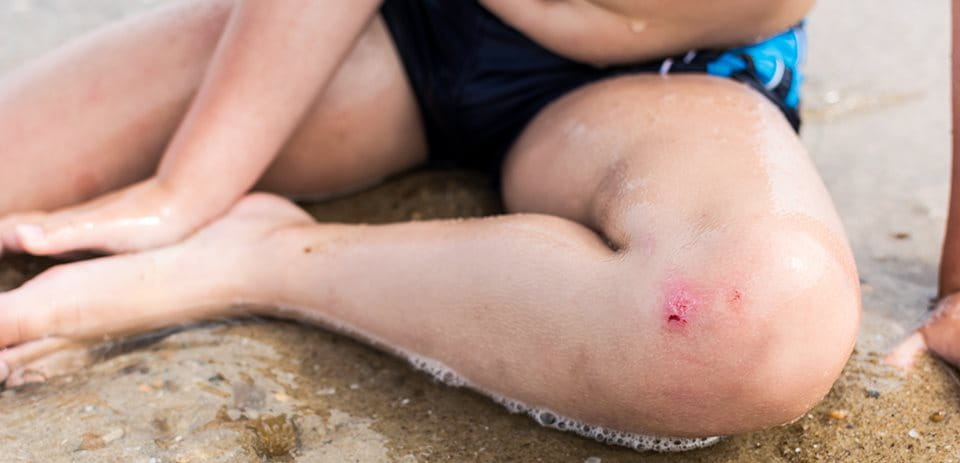 Agua salada y heridas