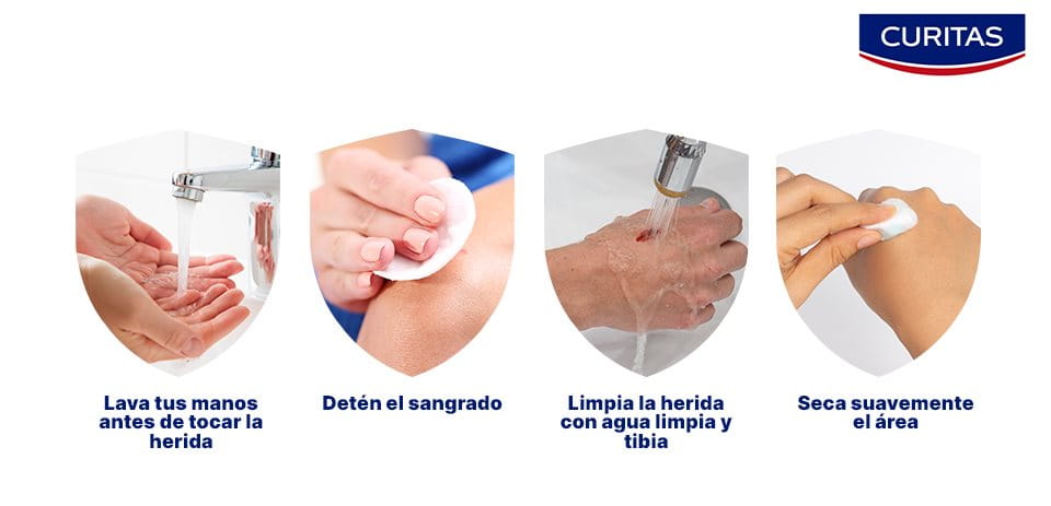 Pasos para limpiar heridas