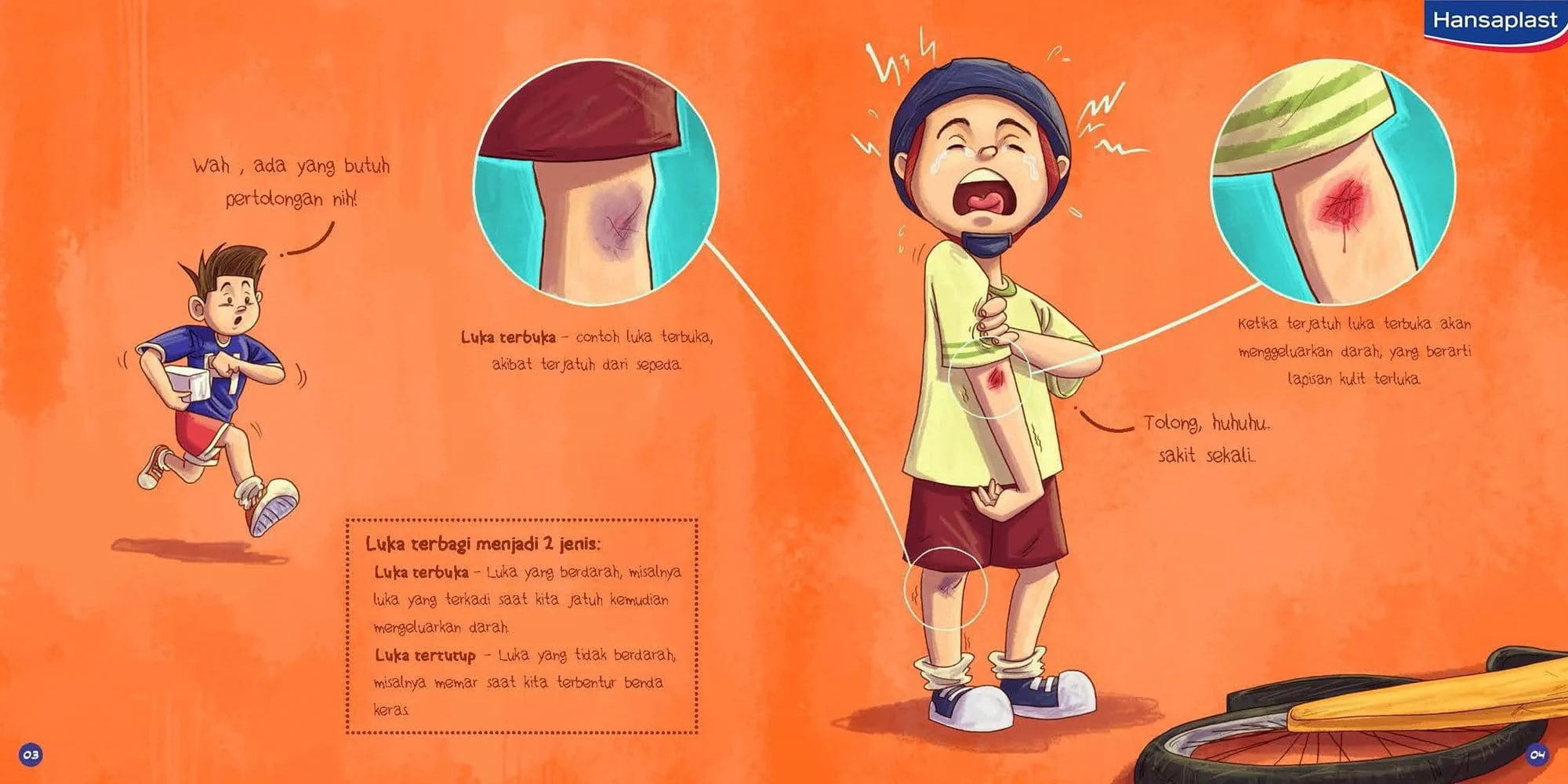 Jenis-jenis luka dijelaskan dengan rinci di buku cerita anak siaga.