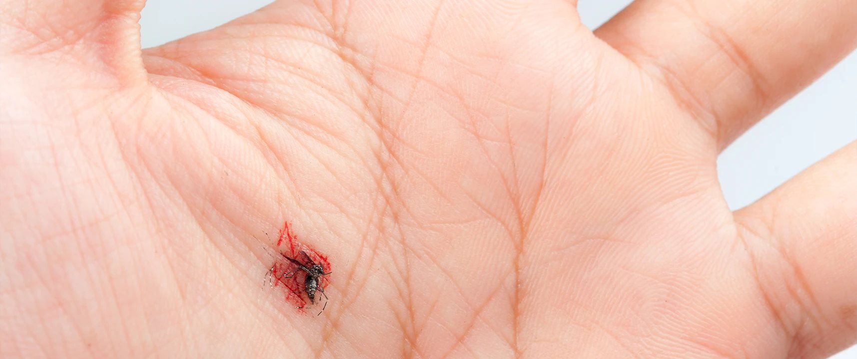 Tangan yang digigit serangga