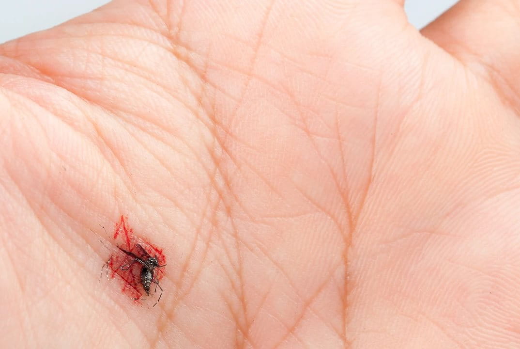 Tangan yang digigit serangga