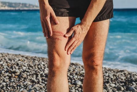 Cómo proteger herida del agua