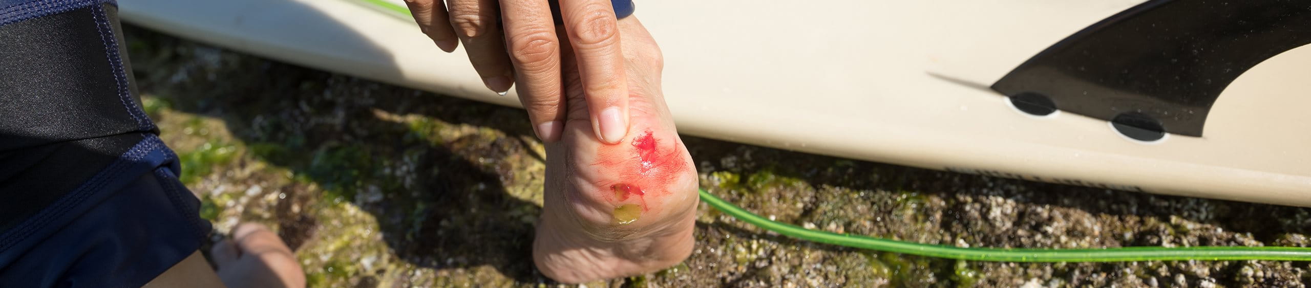 Cómo proteger herida del agua