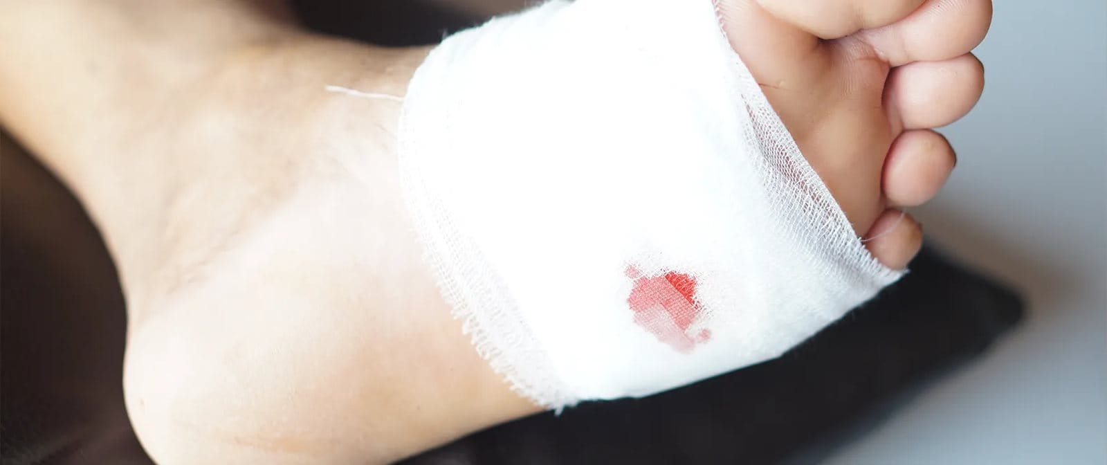 Luka tusuk pada kaki perlu penanganan khusus