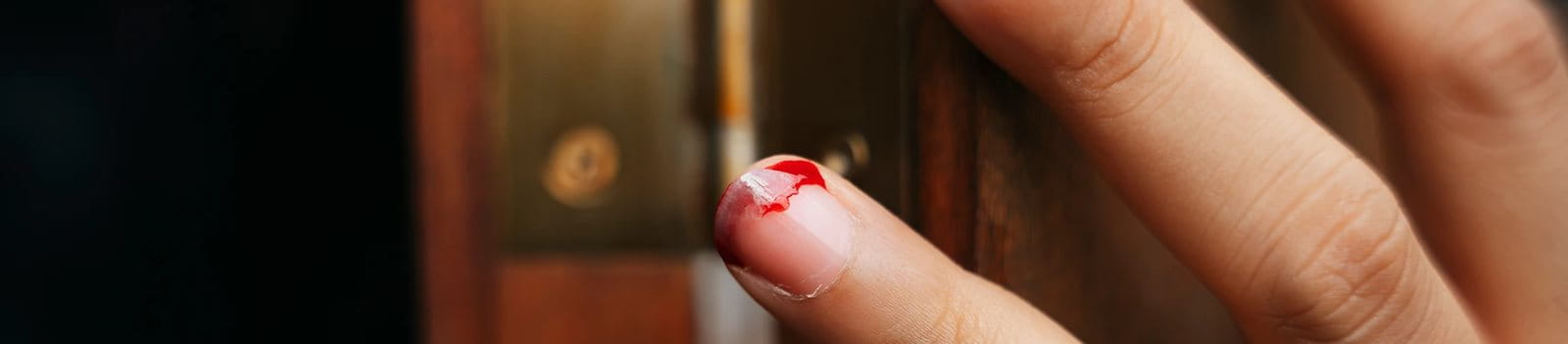 Cara menangani jari kejepit pintu.