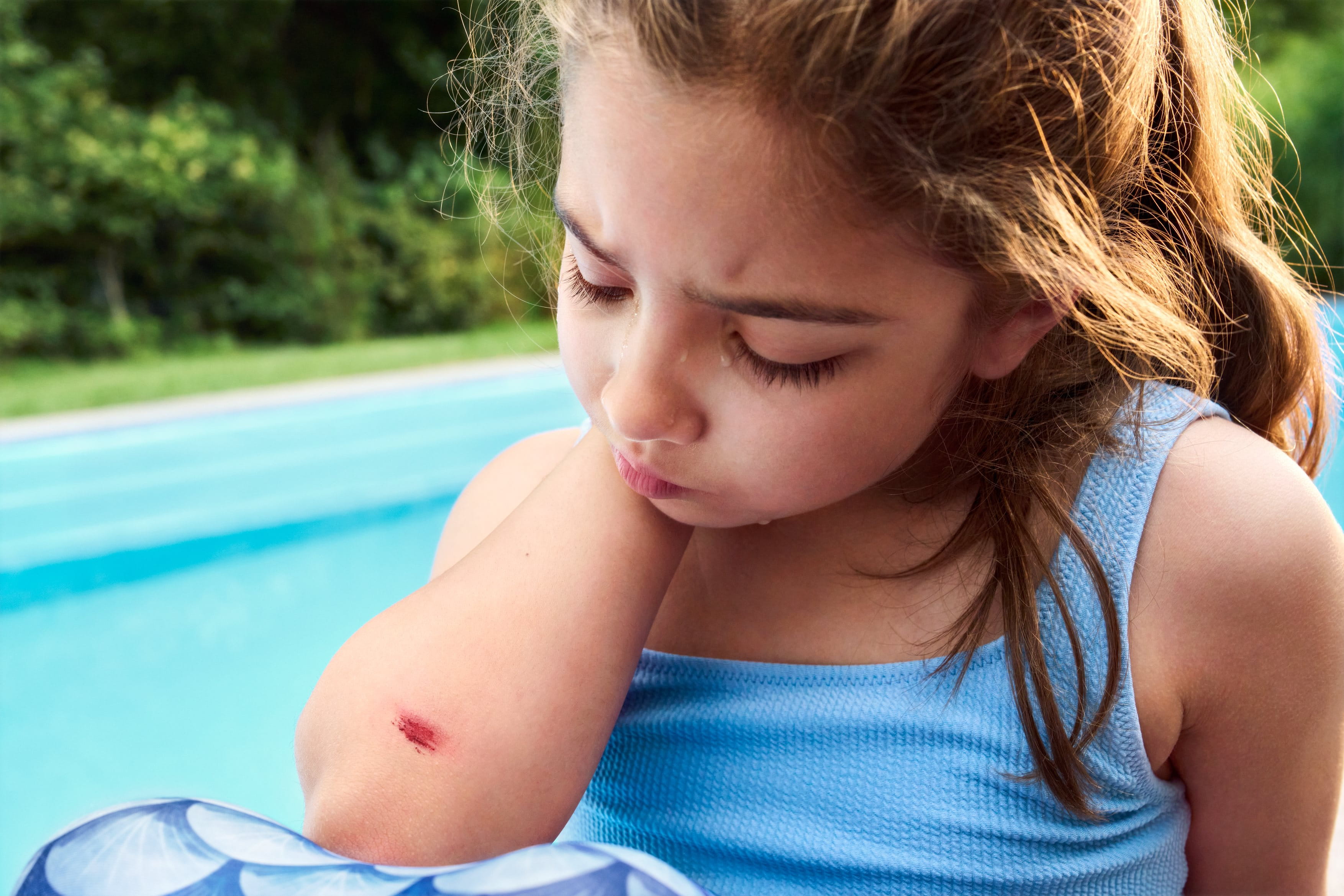 girl with graze on elbow